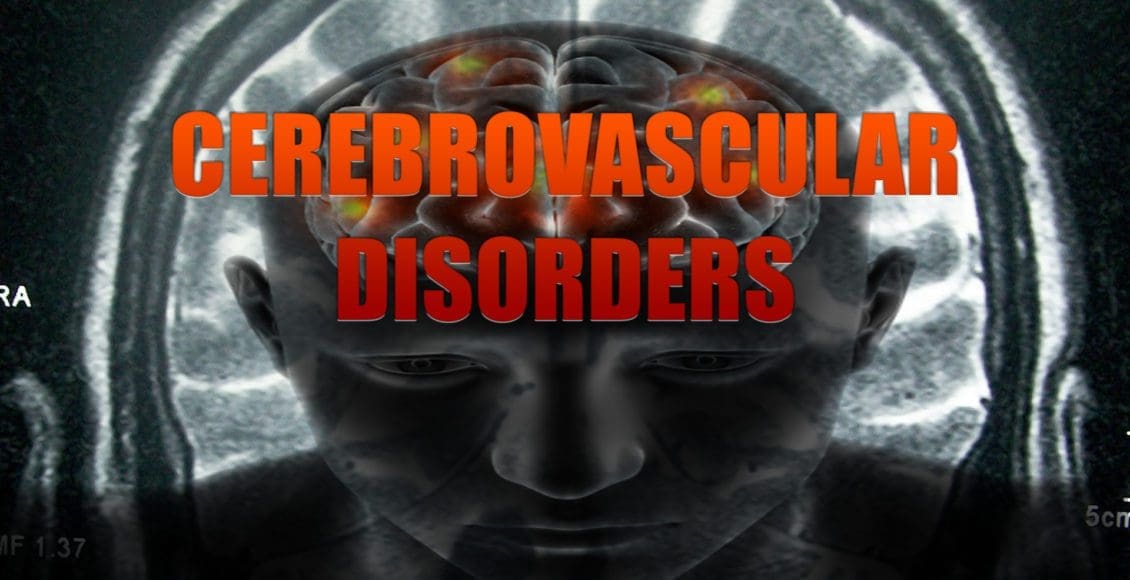 cerebrovascular el paso tx.