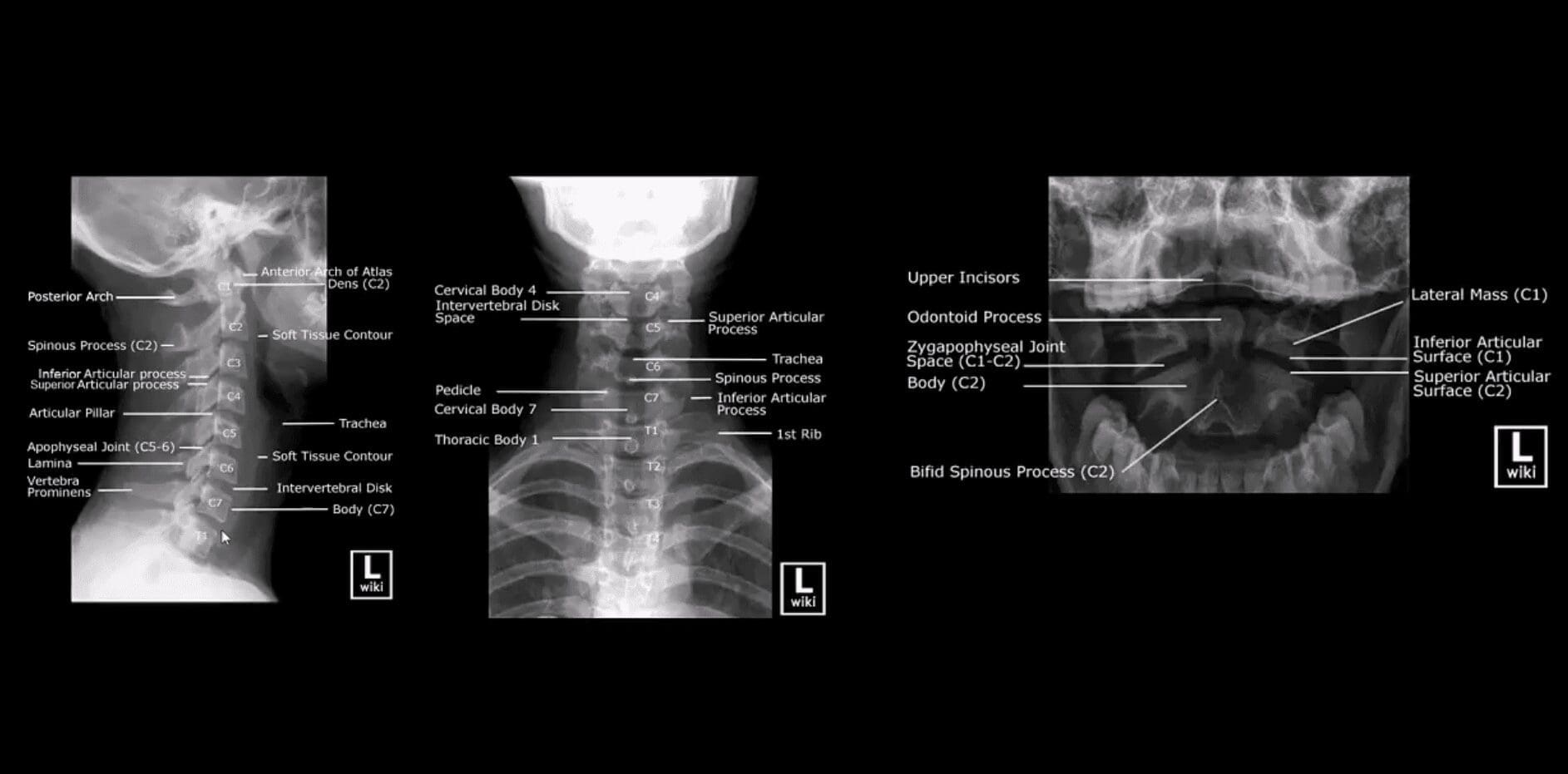 spinal trauma el paso tx.