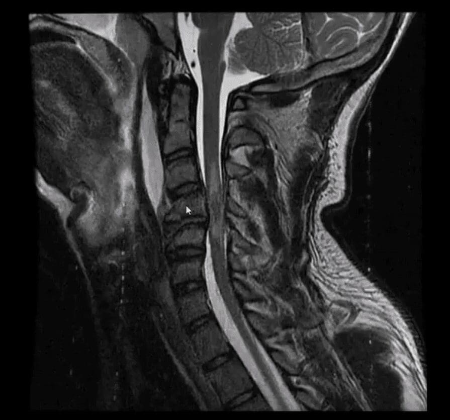 spinal trauma el paso tx.