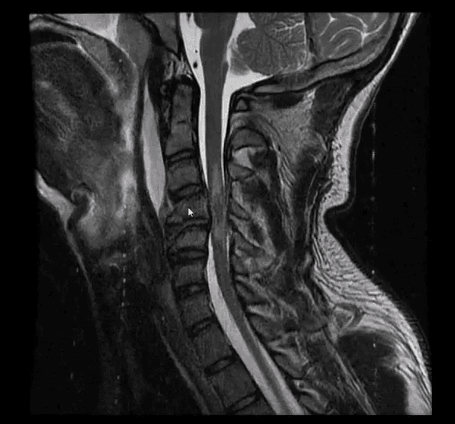 spinal trauma el paso tx.