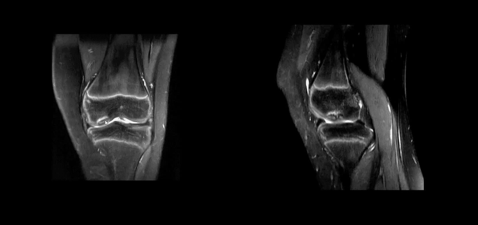 knee pain acute trauma el paso tx.