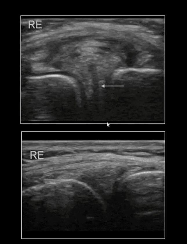 knee pain acute trauma el paso tx.