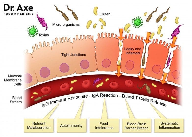 Leaky Gut.jpg