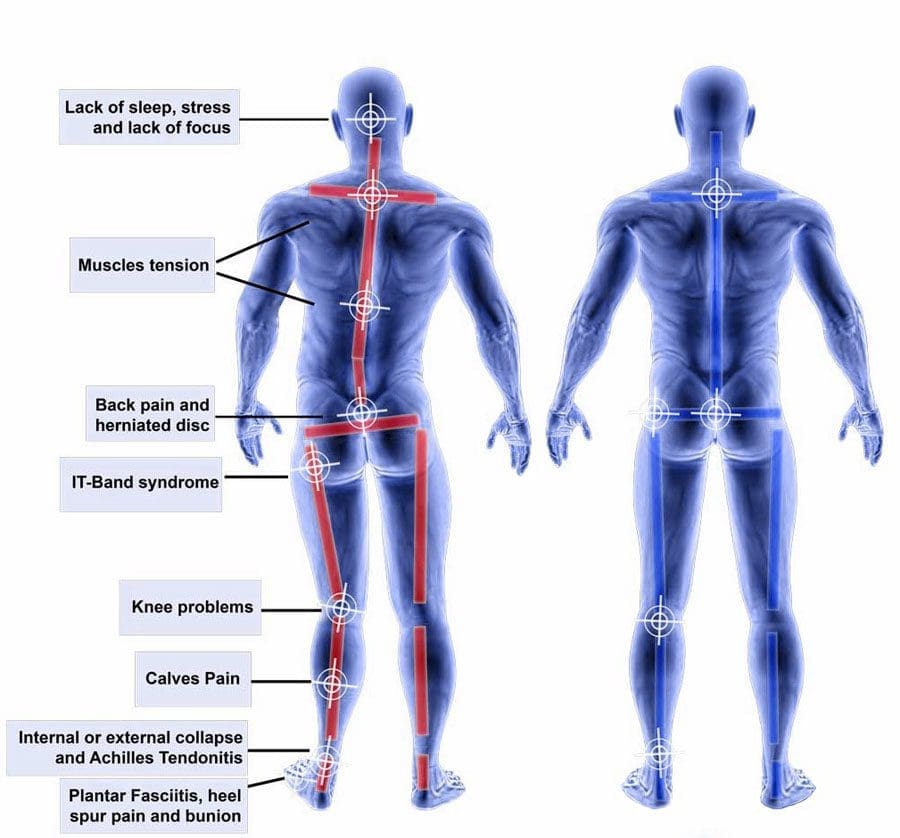 The Link Between Footwear and Back Pain: How to Find Relief