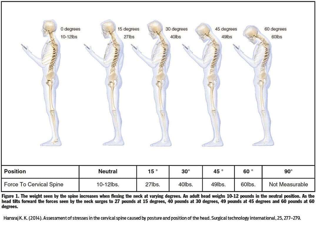 Understanding Forward Head Posture – Avoiding Neck Pain