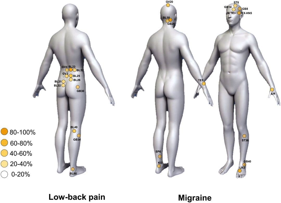 Acupuncture Treatment: A Guide to Unlocking Its Benefits