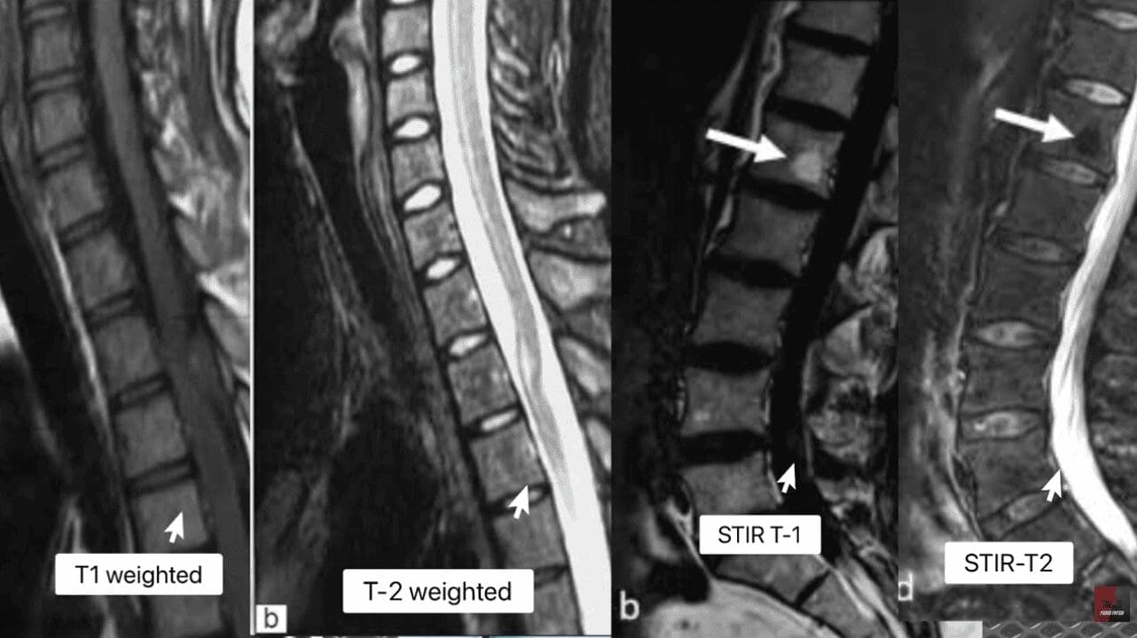 T1 Weighted, T2 Weighted, STIR T1, STIR T2