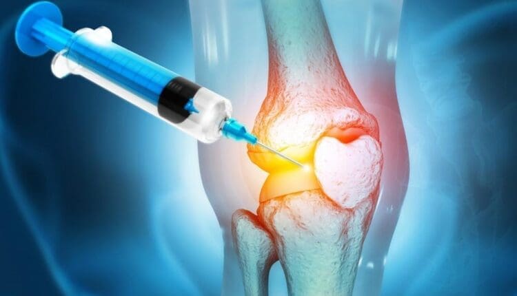 Regenerative Joint Pain Care After MVAs and Work Injuries