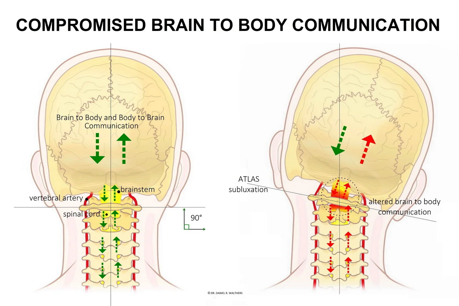 Chiropractic Adjustment