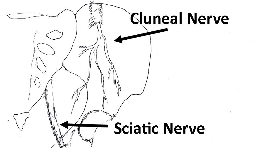 Anatomyclunealnerve.png