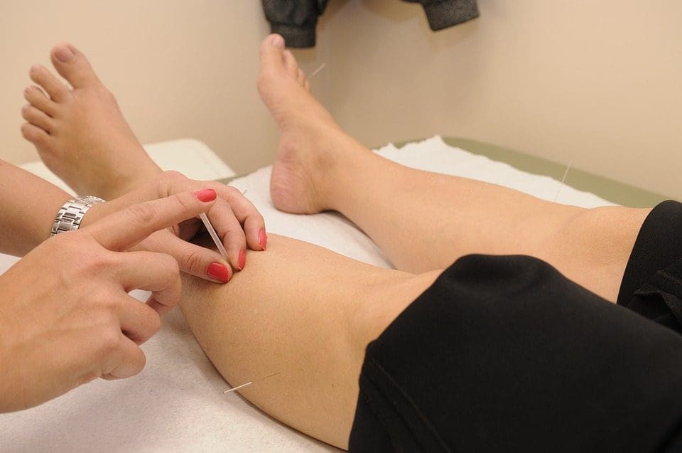 Exploring the Benefits of Acupuncture for Chronic Fatigue