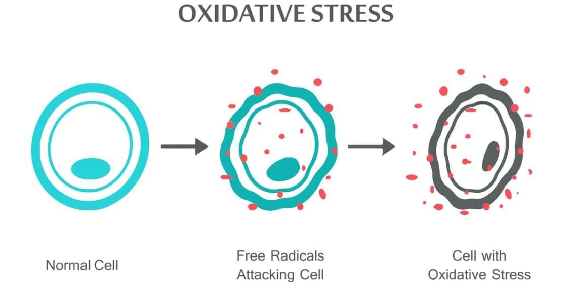 Oxidative stress