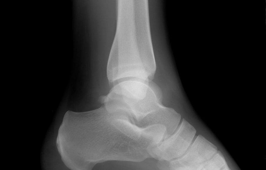 the difference between sprains and strains