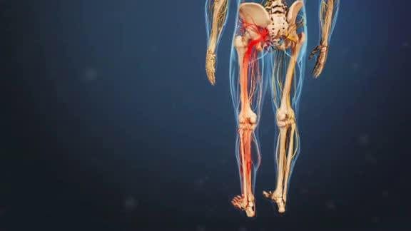 sciatic nerve path