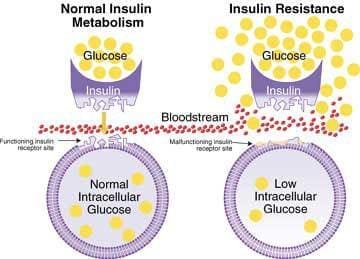 Insulin resistance