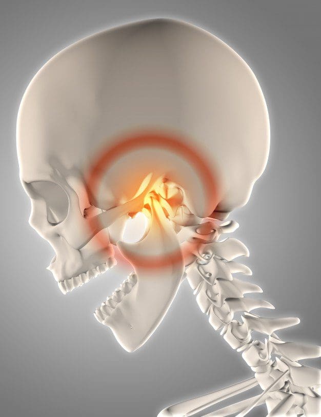 temporomandibular joint disorder el paso tx.