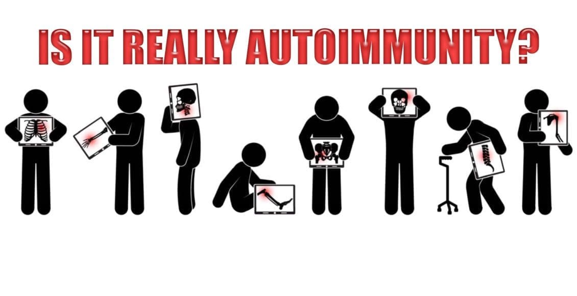autoimmunity el paso tx.