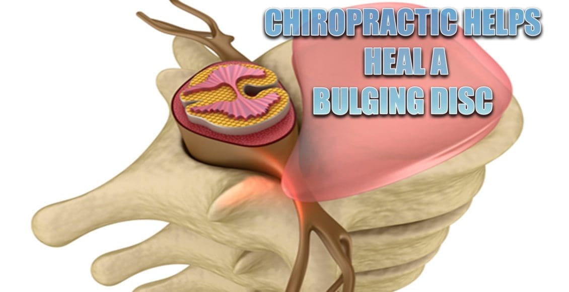 heal bulging disc el paso tx.