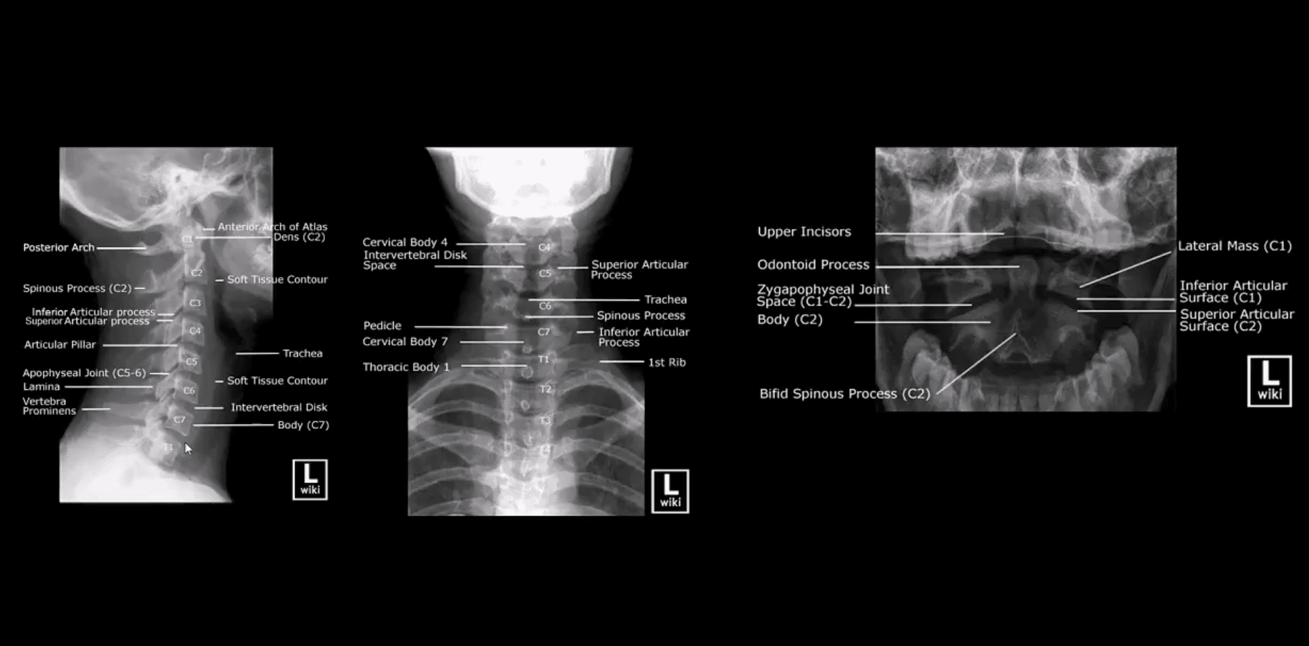 spinal trauma el paso tx.