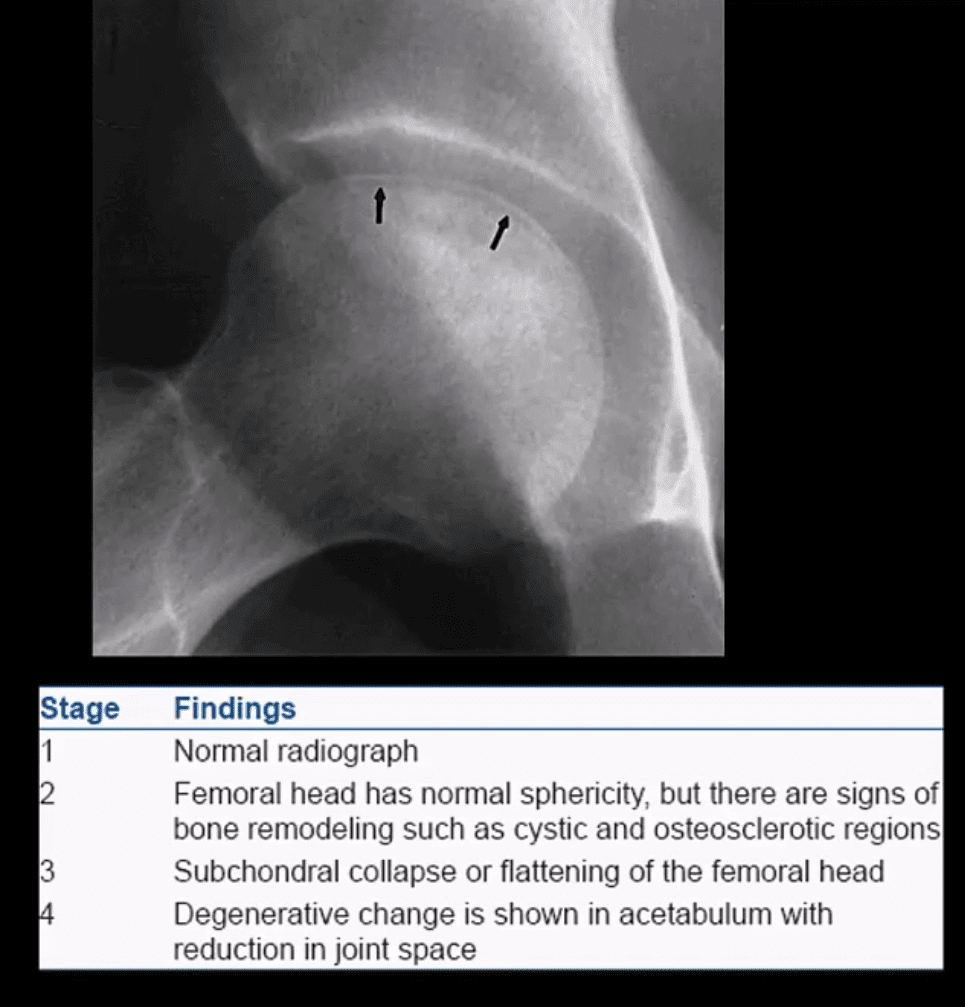 diagnosis hip arthritis and neoplasms el paso, tx.