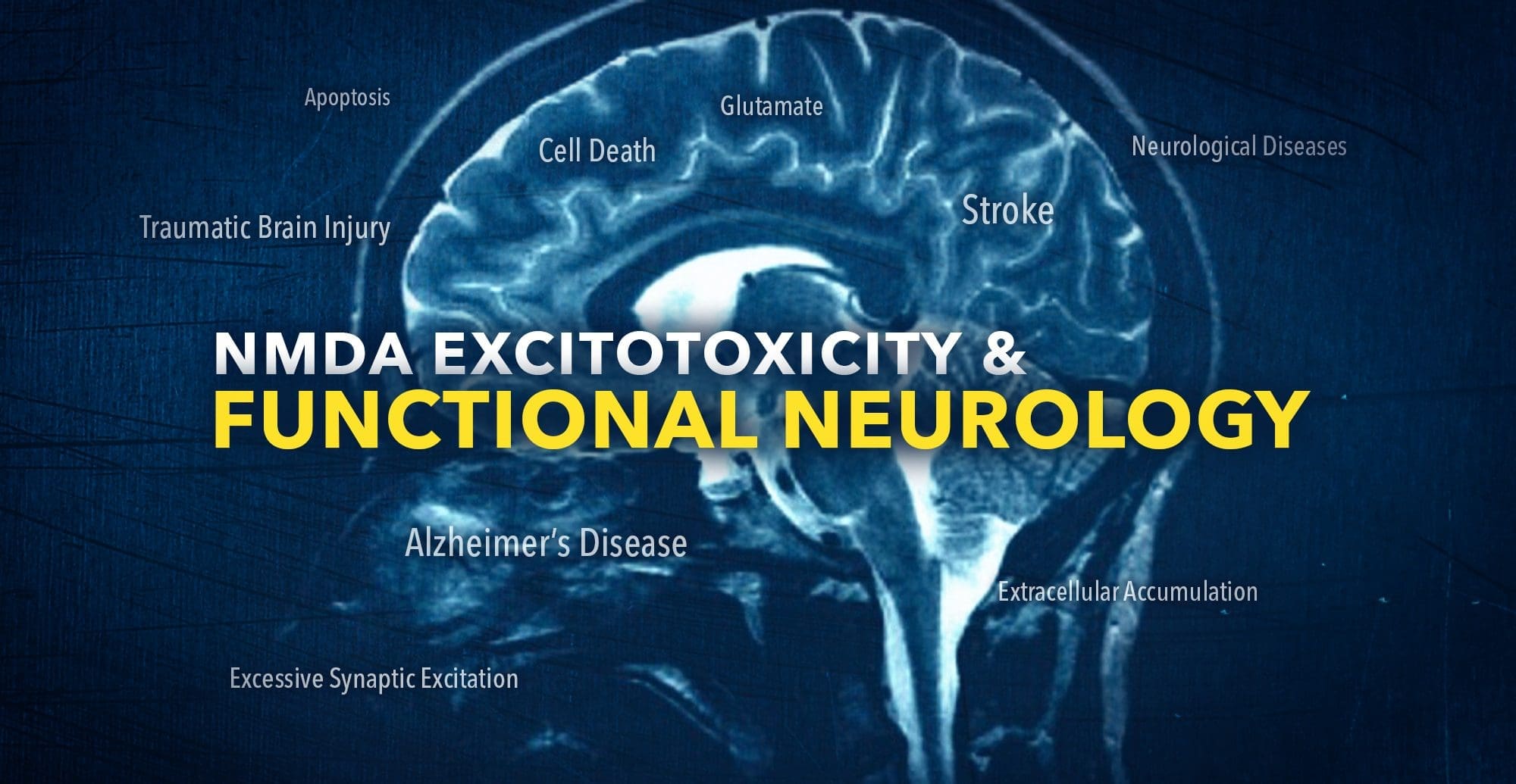 NMDA Excitotoxicity in Functional Neurology | El Paso, TX Chiropractor