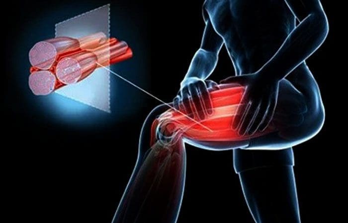 Low Levels of Choline Can Contribute To Muscle Cramps
