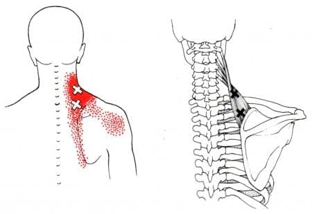 The Levator Scapulae Muscles on Spine Stabilization and Posture