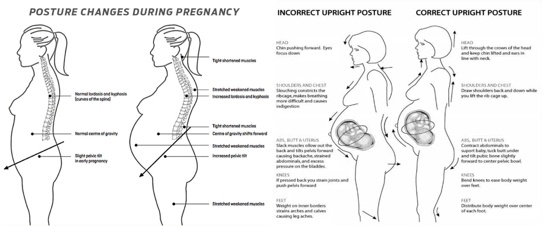 Pregnancy Posture Health: EP Chiropractic Functional Team