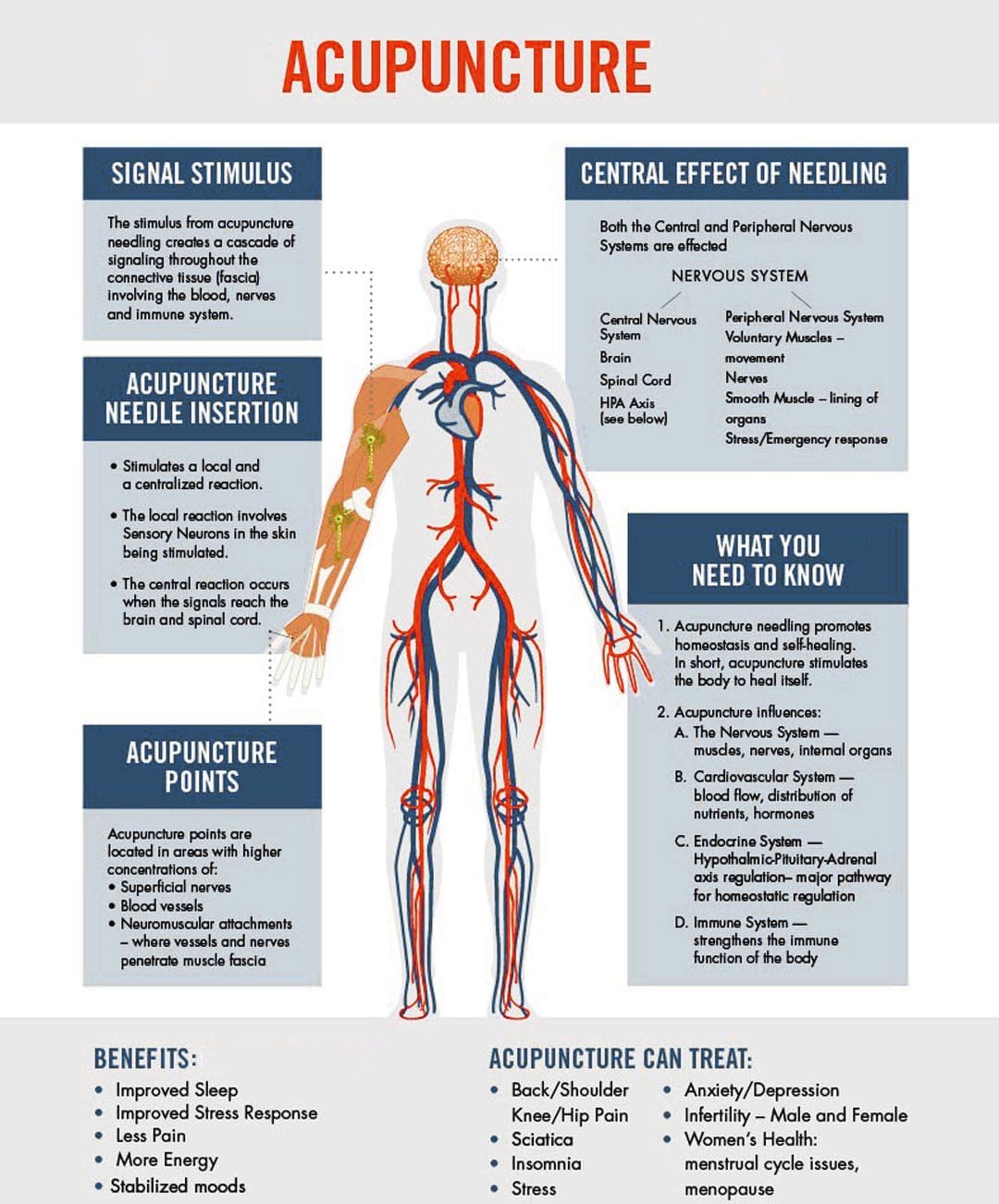 Acupuncture for Pain Management: The Ultimate Guide
