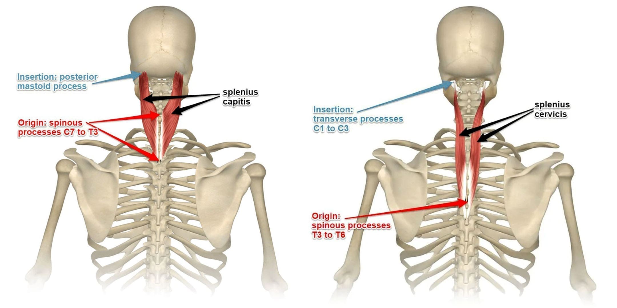 Strengthen Your Posture: The Splenius Capitis Guide